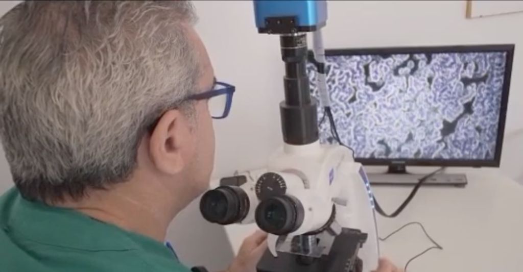 Progetto Cure: Comitato Fortitudo «studio sul sangue dei vaccinati per rispondere alle alterazioni dei globuli rossi In evidenza»